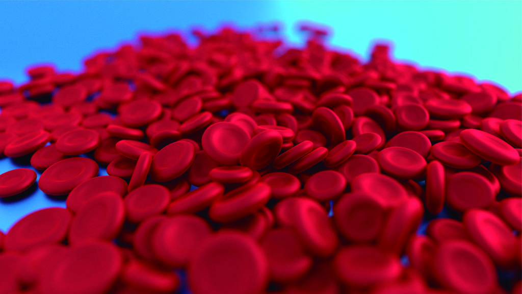 Detección de anemia 1 InfoSalud MIG