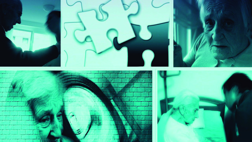 ¿Qué es el alzheimer? 2 InfoSalud MIG