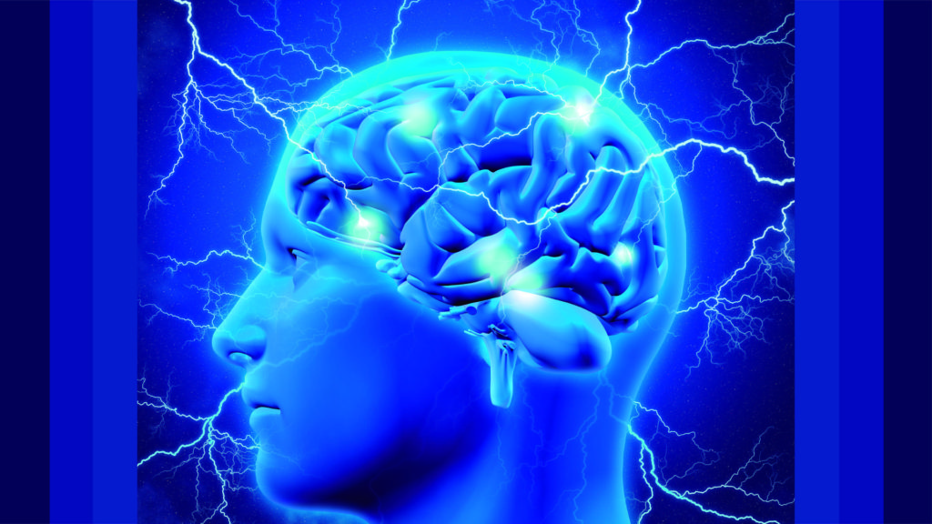 ¿Enfermedad vascular cerebral? 1 InfoSalud MIG