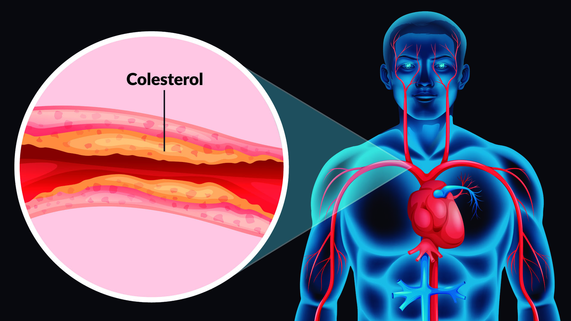 ¿colesterol Alto Hospital De Especialidades Migemk 7640